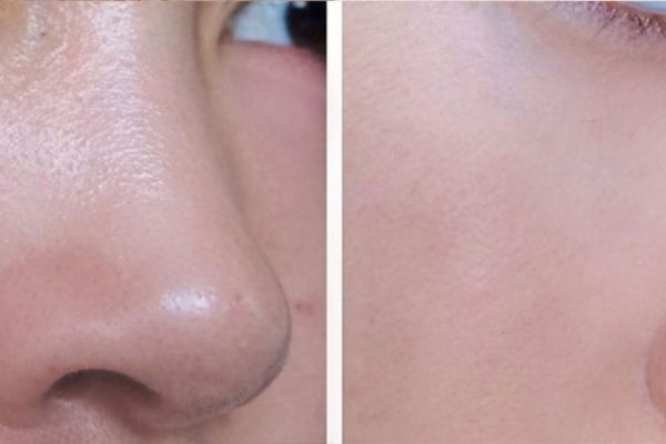 woman-pore-02 woman-pore-02