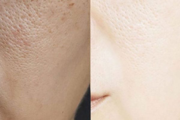 woman-pore-03 woman-pore-03
